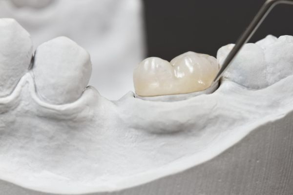 A woman with a cheerful smile, featuring clear braces that enhance her dental aesthetics.